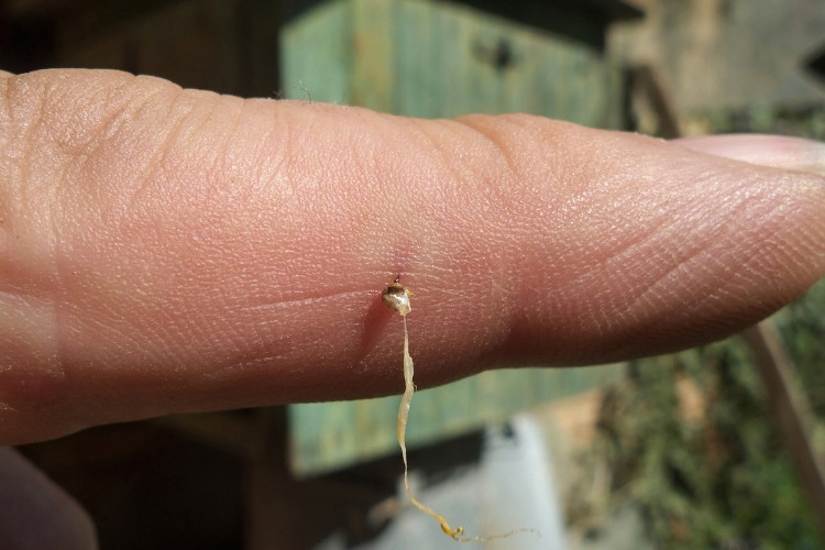 Photo of a honey bee stinger apparatus attached to a person's finger after a sting