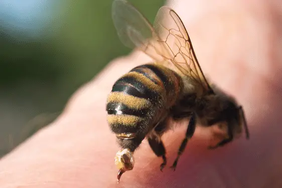 Bee stinging a person's arm